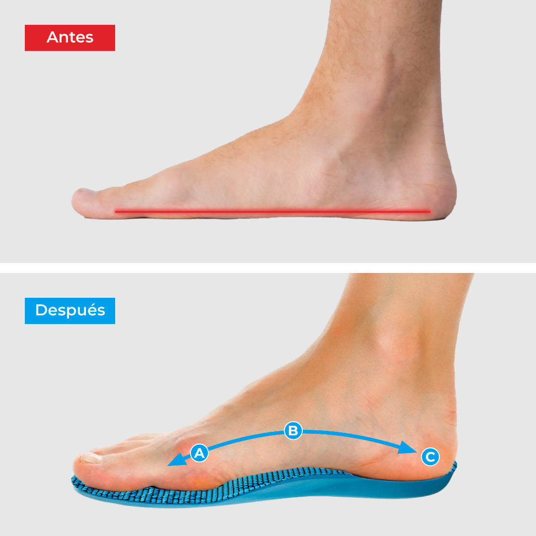 Plantillas ComfyFeet™️ - Disfruta de días sin dolor, sin tratamientos caros ni visitas al médico...