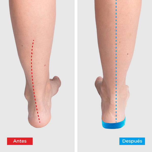 Plantillas ComfyFeet™️ - Disfruta de días sin dolor, sin tratamientos caros ni visitas al médico...